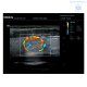 Аппарат УЗИ Mindray DС-60 Pro X-Insight стационарный - Изображение 4