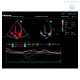 Аппарат УЗИ Mindray DC-70 Pro X-insight стационарный - Изображение 5