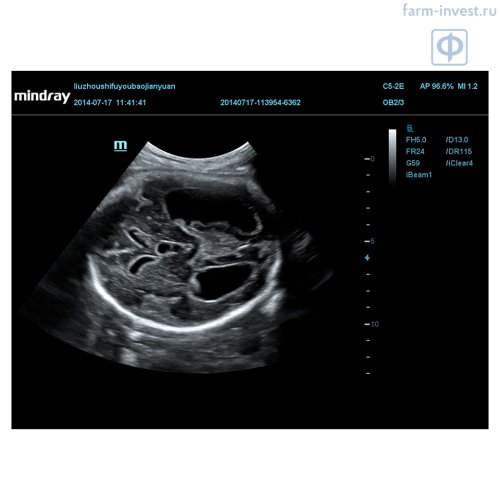 Аппарат УЗИ Mindray DC-70 Pro X-insight стационарный